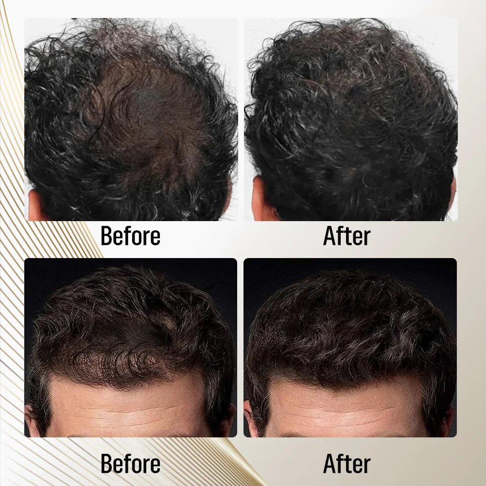 Adglamful Fiber Powder Kit by shoppikala showing hair fibers and application tools for temporary hair thickening.